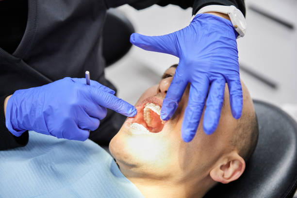 Best Emergency Tooth Extraction in Chinook, MT